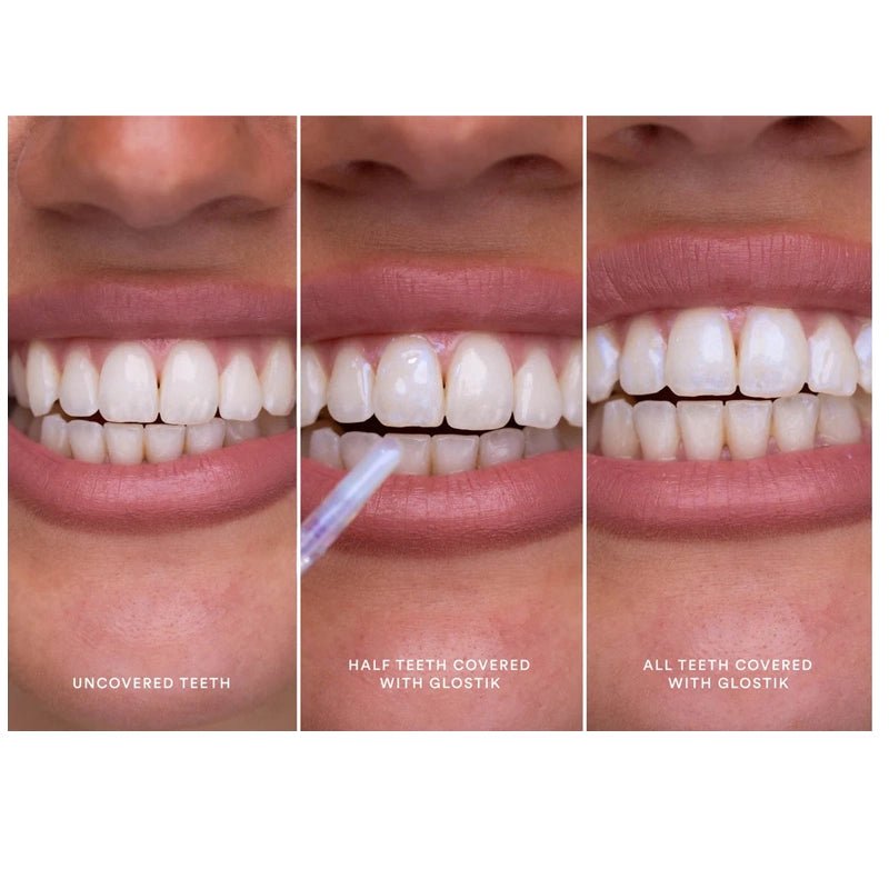 Glostik Instant Teeth Whitening Tooth Gloss - 30ml