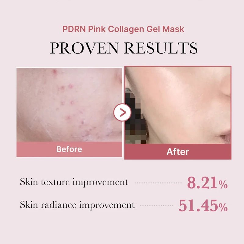 PDRN Pink Collagen Jelly Gel Mask for Hydration, Firming & Glow - 28g