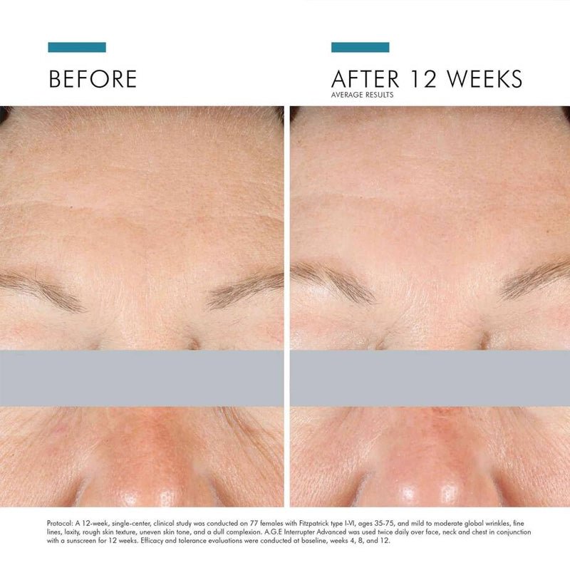 A.G.E. Interrupter Advanced Anti-Wrinkle Face Cream - 48g