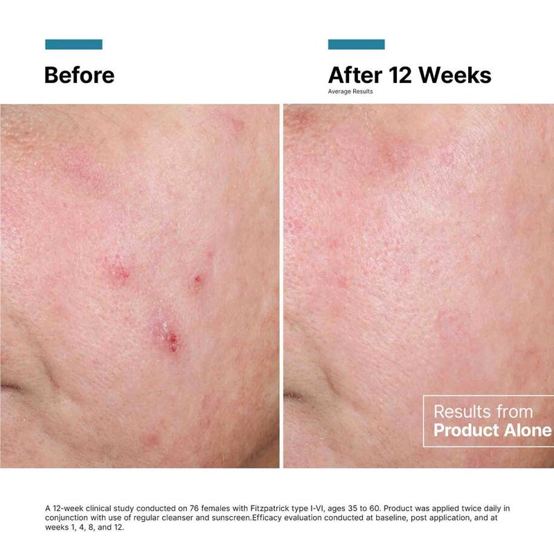 Advanced RGN 6 Skin Regeneration Anti Aging Cream - 50ml