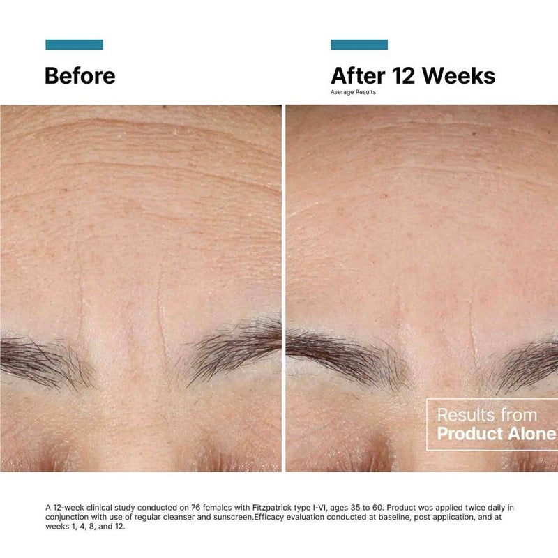 Advanced RGN 6 Skin Regeneration Anti Aging Cream - 50ml