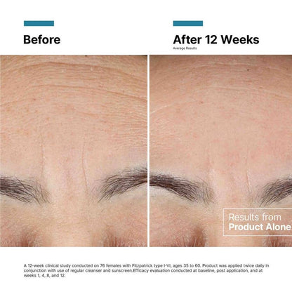 Advanced RGN 6 Skin Regeneration Anti Aging Cream - 50ml