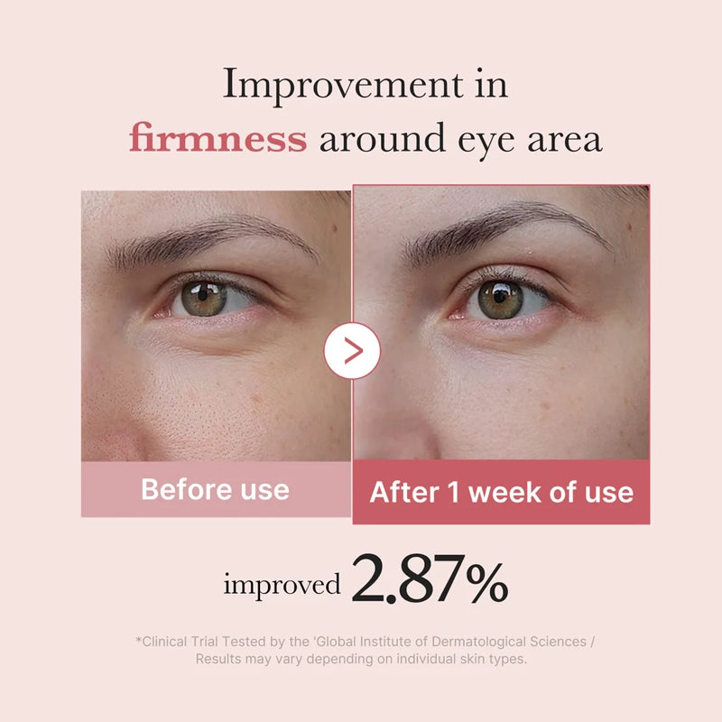 PDRN Pink Peptide Eye Cream for Dark Circles &amp; Wrinkle Care - 30ml