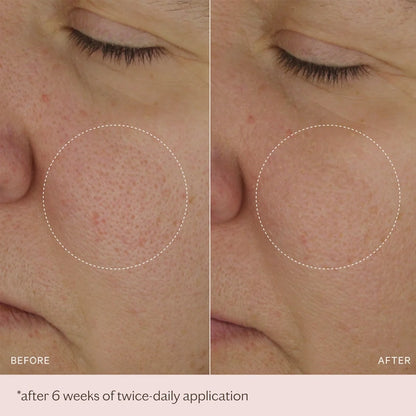 The Light Moisturiser - Lightweight Anti-Ageing Face Cream - 50ml