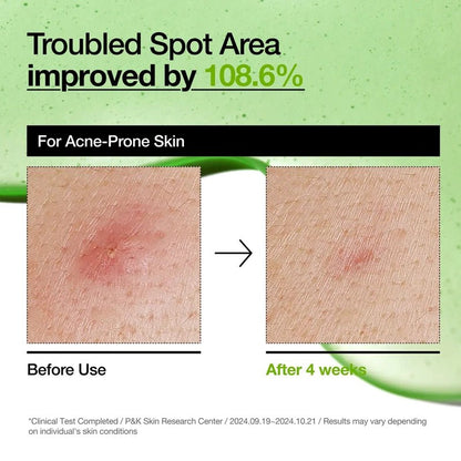 Azelaic Acid 10 Hyaluron Redness Soothing Serum - 30ml