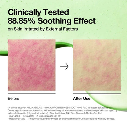 Azelaic Acid 10% Redness Soothing Pads with Hyaluronic Acid - 90pcs