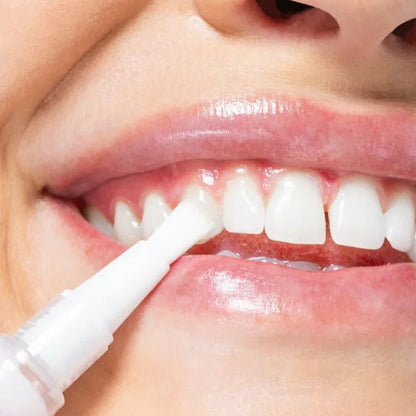 PAP+ Teeth Whitening Pen - 3ml
