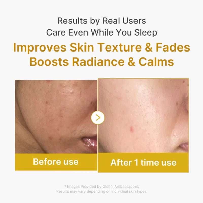 Kojic Acid &amp; Turmeric Brightening Overnight Wrapping Mask - 75ml