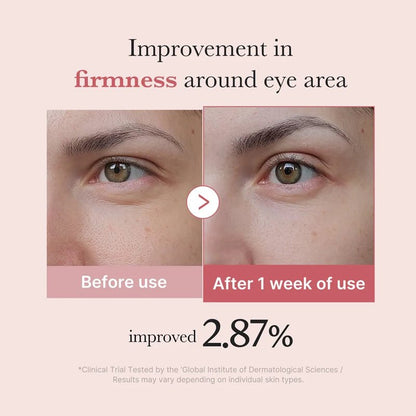 PDRN Pink Peptide Eye Cream for Dark Circles &amp; Wrinkle Care - 30ml