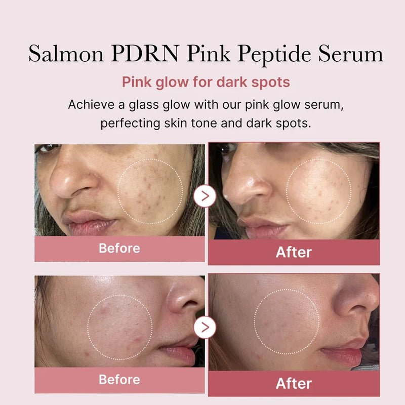 PDRN Pink Peptide Glow Serum - 30ml