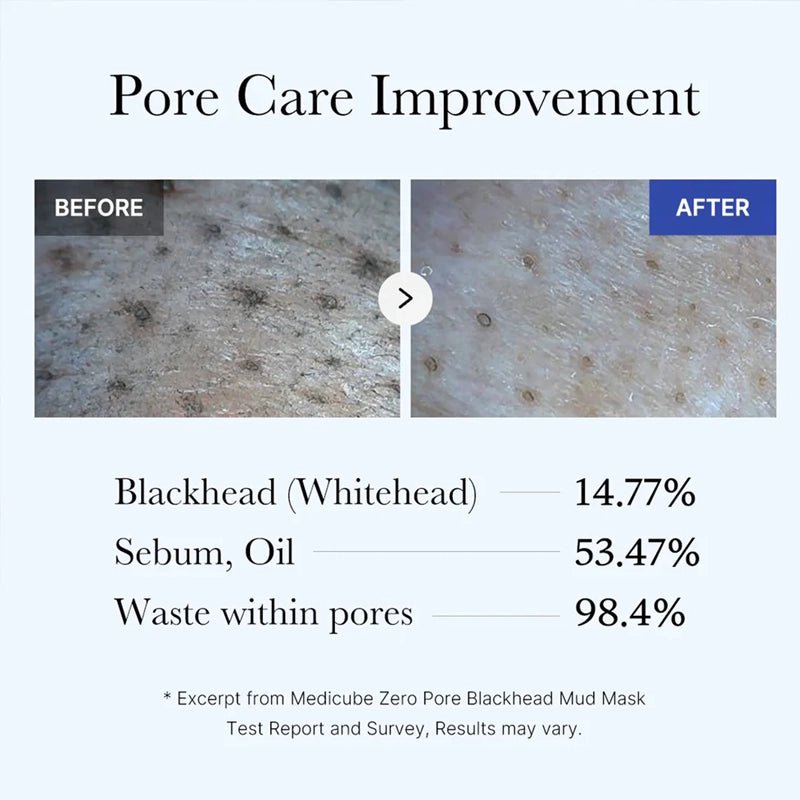 Zero Pore Blackhead Mud Facial Mask for Deep Pore Care - 100g