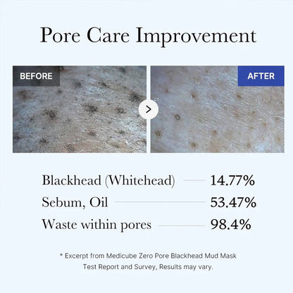 Zero Pore Blackhead Mud Facial Mask for Deep Pore Care - 100g