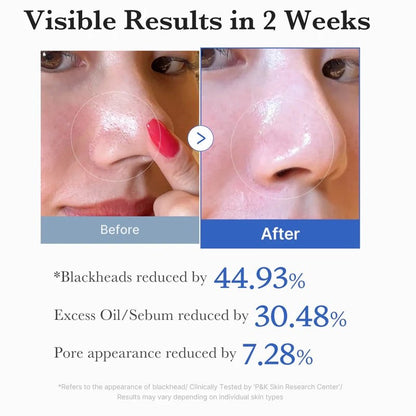 Zero Pore Pad 2.0 - 70pcs