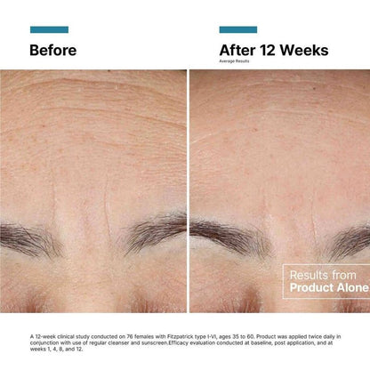 Advanced RGN 6 Skin Regeneration Anti Aging Cream - 50ml