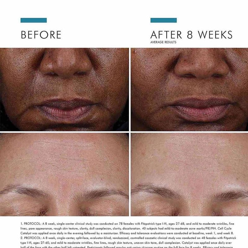 Cell Cycle Catalyst Exfoliating Anti-Aging Skin Renewal Serum - 30ml