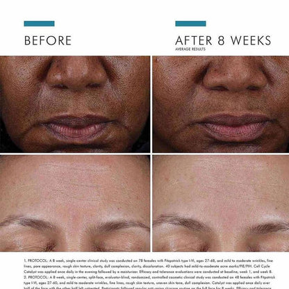 Cell Cycle Catalyst Exfoliating Anti-Aging Skin Renewal Serum - 30ml