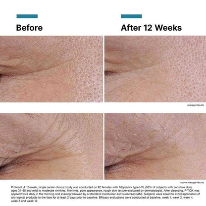 P-TIOX Peptide Anti-Wrinkle Serum for Expression Lines &amp; Glow - 30ml